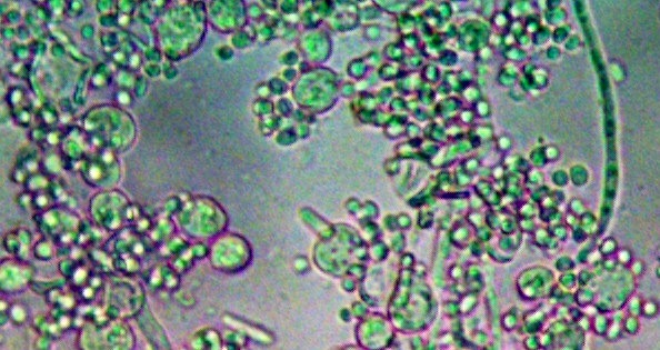 Histoplasma.jpg Histoplasma.jpg